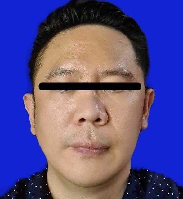 Ketua Pppsrs Apartement Pik Tomy Diciduk Polisi