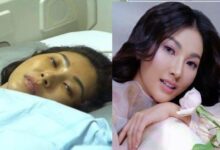 Sarwendah Blak-Blakan Soal Kista Batang Otak, Begini Rasanya Saat Kambuh