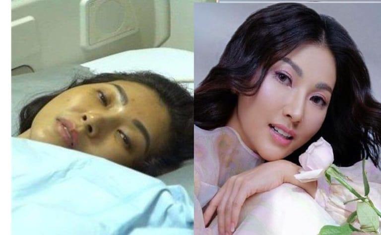 Sarwendah Blak-Blakan Soal Kista Batang Otak, Begini Rasanya Saat Kambuh