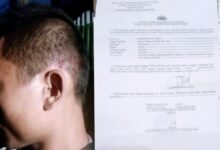 Kapolri Perlu Tahu, Polres Madina 3 Tahun Gagal Tangkap Tersangka Penganiayaan Wartawan Teropongistana.com Jakarta - Wartawan Korban Kekerasan Dan Penganiayaan Sekelompok Orang Diduga Suruhan Juragan Tambang Emas Ilegal Di Kabupaten Mandailing Natal (Madina), Sumatera Utara, Sejak 2022 Hingga Hari Ini Tak Kunjung Ditangkap Polisi. Kasus Ini Menambah Deretan Panjang Banyaknya Ancaman Kepada Jurnalis Tanah Air Yang Tak Kunjung Disadari Berbagai Pihak Sebagai Pilar Keempat Demokrasi Dan Anak Sulung Reformasi 1998 Yang Menggulingkan Pemerintahan Otoriter Dan Korup Orde Baru. Kesadaran Ini Mestinya Juga Menjadi Pedoman Buat Aparat Penegak Hukum, Terutama Kepolisian. Bila Ada Pihak Yang Mencoba Mencederai Kerja Kerja Pers Nasional, Polri Mesti Sigap Mengusut Kasusnya Dengan Tuntas. Jangan Malah Turut Serta Menghalangi Atau Menjadi Pelaku Kriminalisasi Terhadap Wartawan. Publik Baru Saja Dikagetkan Dengan Kasus Kiriman Kepala Babi Tanpa Kuping Ke Kantor Redaksi Tempo. Tidak Berselang Beberapa Hari, Teror Susulan Dilemparkan Ke Halaman Kantor Redaksi Tempo Yang Dikenal Sebagai Media Independen Dan Investigatif.  Sudah Dua Minggu Kasus Ini Viral, Namun Pelakunya Tak Kunjung Ditangkap Pihak Kepolisian. Begitu Juga Kasus Kekerasan Yang Dialami Wartawan Di Kabupaten Madina Bernama Lesmana. Karena Lamanya Kasus Ini Dan Menjadi Ancaman Dan Teror Bagi Kalangan Wartawan Dan Pegiat Anti Korupsi, Lesmana Berharap Kapolri Memberikan Perhatian Serius.  “Jangan Karena Kami Di Daerah Jauh Dari Jakarta, Sehingga Kasus Ini Dipermainkan,” Ujar Lesmana Kepada Info Indonesia Saat Dihubungi Wartawan, 29/3/25. Lesmana Menjelaskan, Pasca Laporannya Di Polsek Siabu, Terduga Pelaku Memang Sudah Ditetapkan Sebagai Tersangka Sejak 2022. Namun, Hingga Saat Ini Tersangka Tersebut Masih Bebas Berkeliaran Dan Polisi Terkesan Berkelit Belum Menemukan Tersangka.  Lesmana Pun Mengisahkan Kasus Yang Menimpanya Beberapa Tahun Lalu Itu. Dia Mengaku Berangkat Ke Lokasi Tambang Di Desa Tangga Bosi Bukit Siayo Pada 27 Maret 2022 Pukul 17.00 Wib.  “Perjalanan Menelusuri Jalan Tikus Yang Cukup Jauh Dan Melelahkan Ini Memakan Waktu 4 Jam Lebih Hingga Tiba Dilokasi Sekitar Jam 21.30 Wib. Saya Bersama Kawan Saya Dua Orang Beristirahat Di Kamp Atau Postnya Hendrik,” Ujarnya. Berselang Beberapa Jam, Tiba-Tiba Segerombolan Orang Merangsek Masuk Ke Gubuk Peristirahatan Tersebut. Seorang Di Antara Mereka Bersuara Lantang Dan Emosi Menanyakan Lesmana. “Setelah Memastikan Saya Adalah Targetnya, Seketika Itu Pula Yang Bersangkutan Memukul Saya Pakai Kayu Di Bagian Kepala Kiri Saya Membabi Buta. Selanjutnya, Saya Perhatikan Yang Bersangkutan Makin Kalap Dan Mencabut Parang,” Terangnya. Lesmana Mengaku Langsung Melakukan Upaya Menyelamatkan Diri Dari Gempuran Tujuh Orang Di Tengah Hutan Lokasi Tambang Tersebut. Begitu Pula Rekan-Rekannya Yang Masing-Masing Menyelamatkan Diri Masing-Masing. &Quot;Alhamdulilah, Kejadian Mengerikan Yang Mengancam Keselamatan Jiwa Kami Malam Itu, Berkat Kuasa Allah Kami Selamat Yang Secara Logika Adalah Keniscayaan Untuk Bisa Selamat. Pria Yang Dikenal Sebagai Jurnalis Kritis Di Kabupaten Madina Ini Menambahkan, Setelah Tiba Di Kampung Pada Pagi Harinya, Segera Melaporkan Kasus Penganiayaan Ini Ke Polsek Siabu. Pihak Penyidik Polsek Siabu Pun Segera Memproses Hingga Ditetapkan Tiga Orang Sebagai Tersangka, Yakni Fulifati Harefa Alias Ama Ope, Gatishoki Gulo Alias Ama Andi, Dan Ama Zulpan Zega. Sayangnya, Hingga Tiga Tahun Berlalu, Kasus Teror Dan Tindakan Kriminal Pembungkaman Terhadap Wartawan Dan Kebebasan Pers Ini Tak Kunjung Berhasil Diungkap Polsek Siabu. “Saya Sangat Kecewa. Kinerja Oknum Polri Di Sini Yang Disebut-Sebut Presisi Oleh Kapolri, Bapak Listiyo Sigit Prabowo, Hanya Slogan Semata Di Polsek Siabu Dan Polres Madina,” Keluh Lesmana. Padahal, Kata Dia, Keberadaan Tersangka Fulifati Harefa, Gatishoki Gulo Dan Ama Zulpan Zega Sering Dijumpai Masyarakat.  “Selain Secara Fisik Yang Bersangkutan Tetap Berada Di Wilayah Madina, Medsos Ketiganya Pun Sering Pamer Kemewahan Dan Mempertontonkan Dirinya Dengan Bergepok-Gepok Uang Di Postingan Medsosnya,” Kata Lesmana Sambil Mengirimkan Bukti Aplikasi Tiktok Yang Bersangkutan. Dikatakan Lesmana, Kapolres Madina Bersama Jajarannya Tidak Serius Dalam Menangani Perkara Penganiayaan Tersebut Dan Seakan Ada Yang Disembunyikan. &Quot;Saya Menduga Kuat Ada Setoran Mengalir Dari Para Bos Tambang Emas Ilegal Tersebut Kepada Oknum Polisi Di Polres Madina Sektor Polsek Siabu. Aneh Saja Selama 3 Tahun Pelaku Bebas Berkeliaran Sambil Bermain Tiktok Dengan Memperlihatkan Tumpukan Uang,” Tegasnya. Lesmana Juga Menyebut, Kegiatan Penambangan Ilegal, Khususnya Emas, Terus Berlangsung Dan Belum Ada Tindakan Tegas Yang Dilakukan Pemerintah, Mulai Dari Desa, Kecamatan, Hingga Penegak Hukum, Yang Semuanya Terkesan Membiarkan. “Seakan Pelaku Dan Bos Tambang Emas Ilegal Tersebut Lebih Kuasa Dan Sakti Dari Kepolisan. Hal Ini Terindikasi Kuat Dari Pengamanan Perkara Ini Selam Tiga Tahun Polres Madina Yang Tidak Sanggup Menangkap Tersangka,” Ungkapnya. Di Tempat Yang Berbeda, Nani Maulana, Penggiat Lingkungan Mata Tunas 17 Mengatakan, Sah-Sah Saja Jika Korban Mempunyai Dugaan Oknum Polres Madina Menerima Setoran Dari Bos Tambang Emas Ilegal Karena Sudah 3 Tahun Kasusnya Tidak Ada Hasil. &Quot;Apalagi Pelaku Sering Meneror Dan Nomor Teleponnya Aktif, Bahkan Sering Mengancam Korban. Aneh Jika Polisi Tidak Bisa Melacak Keberadaanya Tersangka,” Kata Nani Maulana. Info Indonesia Yang Mengkonfirmasi Progres Kasus Ini Ke Plt Kapolsek Siabu, Rizki Anwar, Lewat Ponselnya Hanya Menyatakan Kesediaannya Menjelaskannya Di Kantornya. Sementara Itu, Kapolres Madina, Akbp Arie Sofandi Paloh, Belum Memberikan Penjelasan Kendala Dan Hambatan Jajarannya Dalam Menangkap Tersangka Penganiayaan Wartawan Tersebut.