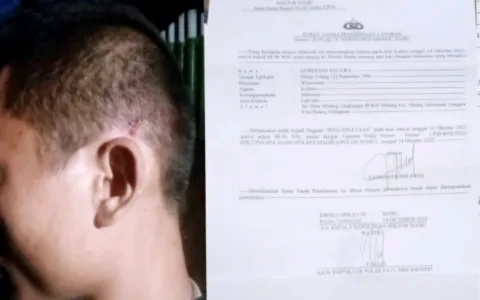 Kapolri Perlu Tahu, Polres Madina 3 Tahun Gagal Tangkap Tersangka Penganiayaan Wartawan Teropongistana.com JAKARTA - Wartawan korban kekerasan dan penganiayaan sekelompok orang diduga suruhan juragan tambang emas ilegal di Kabupaten Mandailing Natal (Madina), Sumatera Utara, sejak 2022 hingga hari ini tak kunjung ditangkap polisi. Kasus ini menambah deretan panjang banyaknya ancaman kepada jurnalis Tanah Air yang tak kunjung disadari berbagai pihak sebagai pilar keempat demokrasi dan anak sulung reformasi 1998 yang menggulingkan pemerintahan otoriter dan korup Orde Baru. Kesadaran ini mestinya juga menjadi pedoman buat aparat penegak hukum, terutama kepolisian. Bila ada pihak yang mencoba mencederai kerja kerja pers nasional, polri mesti sigap mengusut kasusnya dengan tuntas. Jangan malah turut serta menghalangi atau menjadi pelaku kriminalisasi terhadap wartawan. Publik baru saja dikagetkan dengan kasus kiriman kepala babi tanpa kuping ke kantor redaksi Tempo. Tidak berselang beberapa hari, teror susulan dilemparkan ke halaman kantor redaksi Tempo yang dikenal sebagai media independen dan investigatif.  Sudah dua minggu kasus ini viral, namun pelakunya tak kunjung ditangkap pihak kepolisian. Begitu juga kasus kekerasan yang dialami wartawan di Kabupaten Madina bernama Lesmana. Karena lamanya kasus ini dan menjadi ancaman dan teror bagi kalangan wartawan dan pegiat anti korupsi, Lesmana berharap Kapolri memberikan perhatian serius.  “Jangan karena kami di daerah jauh dari Jakarta, sehingga kasus ini dipermainkan,” ujar Lesmana kepada Info Indonesia saat dihubungi wartawan, 29/3/25. Lesmana menjelaskan, pasca laporannya di Polsek Siabu, terduga pelaku memang sudah ditetapkan sebagai tersangka sejak 2022. Namun, hingga saat ini tersangka tersebut masih bebas berkeliaran dan polisi terkesan berkelit belum menemukan tersangka.  Lesmana pun mengisahkan kasus yang menimpanya beberapa tahun lalu itu. Dia mengaku berangkat ke lokasi tambang di Desa Tangga Bosi Bukit Siayo pada 27 Maret 2022 pukul 17.00 WIB.  “Perjalanan menelusuri jalan tikus yang cukup jauh dan melelahkan ini memakan waktu 4 jam lebih hingga tiba dilokasi sekitar jam 21.30 WIB. Saya bersama kawan saya dua orang beristirahat di kamp atau postnya Hendrik,” ujarnya. Berselang beberapa jam, tiba-tiba segerombolan orang merangsek masuk ke gubuk peristirahatan tersebut. Seorang di antara mereka bersuara lantang dan emosi menanyakan Lesmana. “Setelah memastikan saya adalah targetnya, seketika itu pula yang bersangkutan memukul saya pakai kayu di bagian kepala kiri saya membabi buta. Selanjutnya, saya perhatikan yang bersangkutan makin kalap dan mencabut parang,” terangnya. Lesmana mengaku langsung melakukan upaya menyelamatkan diri dari gempuran tujuh orang di tengah hutan lokasi tambang tersebut. Begitu pula rekan-rekannya yang masing-masing menyelamatkan diri masing-masing. "Alhamdulilah, kejadian mengerikan yang mengancam keselamatan jiwa kami malam itu, berkat kuasa Allah kami selamat yang secara logika adalah keniscayaan untuk bisa selamat. Pria yang dikenal sebagai jurnalis kritis di Kabupaten Madina ini menambahkan, setelah tiba di kampung pada pagi harinya, segera melaporkan kasus penganiayaan ini ke Polsek Siabu. Pihak penyidik Polsek Siabu pun segera memproses hingga ditetapkan tiga orang sebagai tersangka, yakni Fulifati Harefa alias Ama Ope, Gatishoki Gulo alias Ama Andi, dan Ama Zulpan Zega. Sayangnya, hingga tiga tahun berlalu, kasus teror dan tindakan kriminal pembungkaman terhadap wartawan dan kebebasan pers ini tak kunjung berhasil diungkap Polsek Siabu. “Saya sangat kecewa. Kinerja oknum polri di sini yang disebut-sebut Presisi oleh Kapolri, Bapak Listiyo Sigit Prabowo, hanya slogan semata di Polsek Siabu dan Polres Madina,” keluh Lesmana. Padahal, kata dia, keberadaan tersangka Fulifati Harefa, Gatishoki Gulo dan Ama Zulpan Zega sering dijumpai masyarakat.  “Selain secara fisik yang bersangkutan tetap berada di wilayah Madina, medsos ketiganya pun sering pamer kemewahan dan mempertontonkan dirinya dengan bergepok-gepok uang di postingan medsosnya,” kata Lesmana sambil mengirimkan bukti aplikasi tiktok yang bersangkutan. Dikatakan Lesmana, Kapolres Madina bersama jajarannya tidak serius dalam menangani perkara penganiayaan tersebut dan seakan ada yang disembunyikan. "Saya menduga kuat ada setoran mengalir dari para bos tambang emas ilegal tersebut kepada oknum polisi di Polres Madina sektor Polsek Siabu. Aneh saja selama 3 tahun pelaku bebas berkeliaran sambil bermain TikTok dengan memperlihatkan tumpukan uang,” tegasnya. Lesmana juga menyebut, kegiatan penambangan ilegal, khususnya emas, terus berlangsung dan belum ada tindakan tegas yang dilakukan pemerintah, mulai dari desa, kecamatan, hingga penegak hukum, yang semuanya terkesan membiarkan. “Seakan pelaku dan bos tambang emas ilegal tersebut lebih kuasa dan sakti dari kepolisan. Hal ini terindikasi kuat dari pengamanan perkara ini selam tiga tahun Polres Madina yang tidak sanggup menangkap tersangka,” ungkapnya. Di tempat yang berbeda, Nani Maulana, penggiat lingkungan Mata Tunas 17 mengatakan, sah-sah saja jika korban mempunyai dugaan oknum Polres Madina menerima setoran dari bos tambang emas ilegal karena sudah 3 tahun kasusnya tidak ada hasil. "Apalagi pelaku sering meneror dan nomor teleponnya aktif, bahkan sering mengancam korban. Aneh jika polisi tidak bisa melacak keberadaanya tersangka,” kata Nani Maulana. Info Indonesia yang mengkonfirmasi progres kasus ini ke Plt Kapolsek Siabu, Rizki Anwar, lewat ponselnya hanya menyatakan kesediaannya menjelaskannya di kantornya. Sementara itu, Kapolres Madina, AKBP Arie Sofandi Paloh, belum memberikan penjelasan kendala dan hambatan jajarannya dalam menangkap tersangka penganiayaan wartawan tersebut.